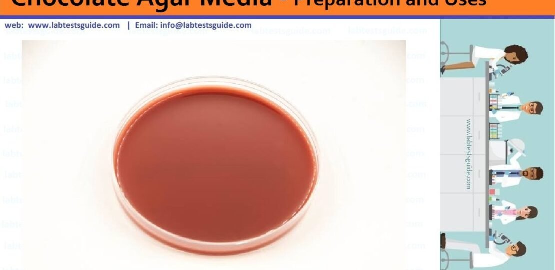 Chocolate-Agar