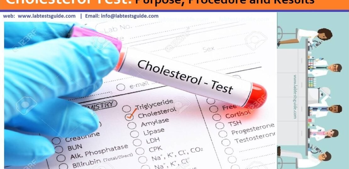 Cholesterol-Test