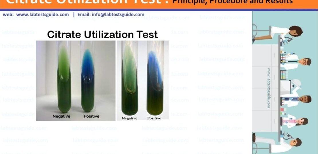 Citrate-Test