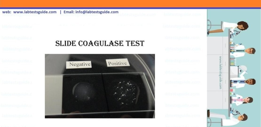 Coagulase-Tube-Method