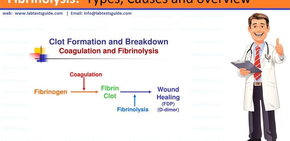 Fibrinolysis