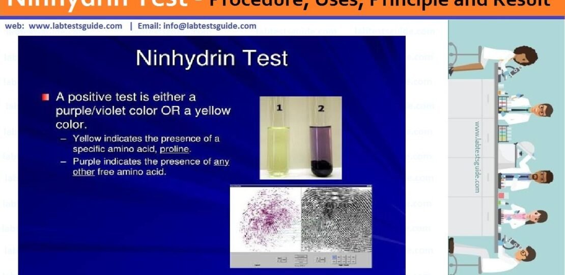 Ninhydrin-Test