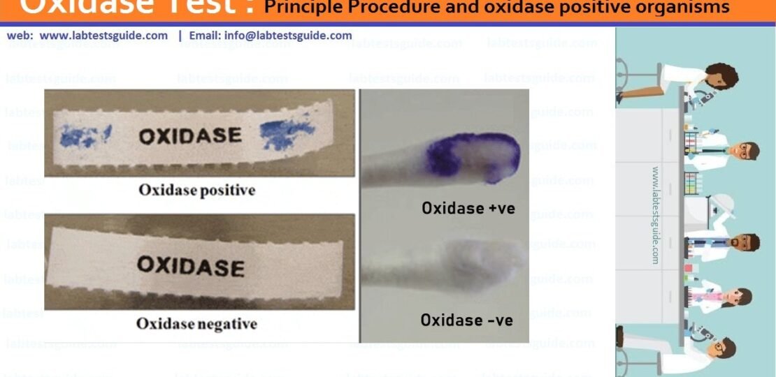 Oxidase-Test