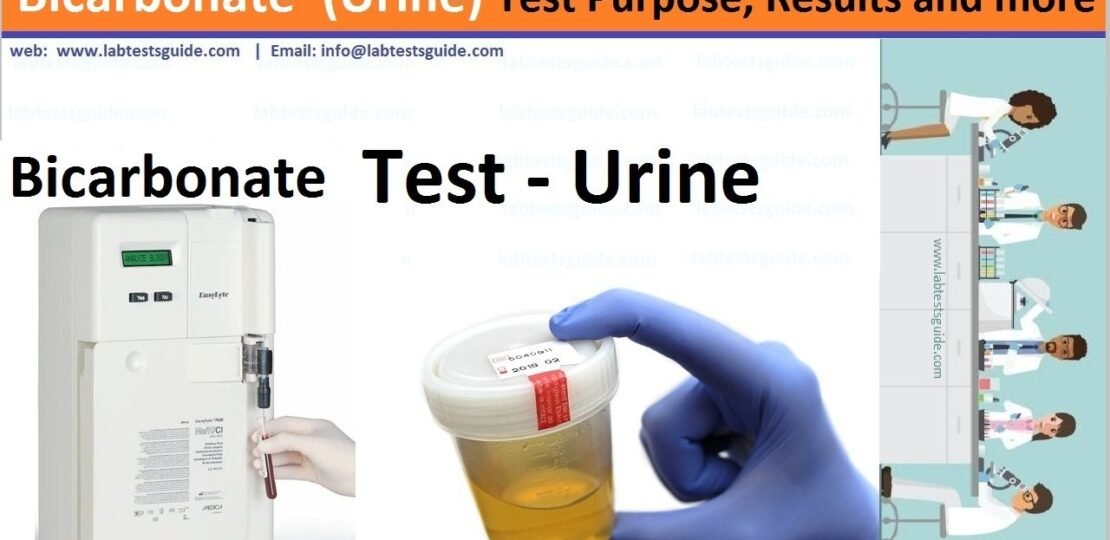 Bicarbonate Urine