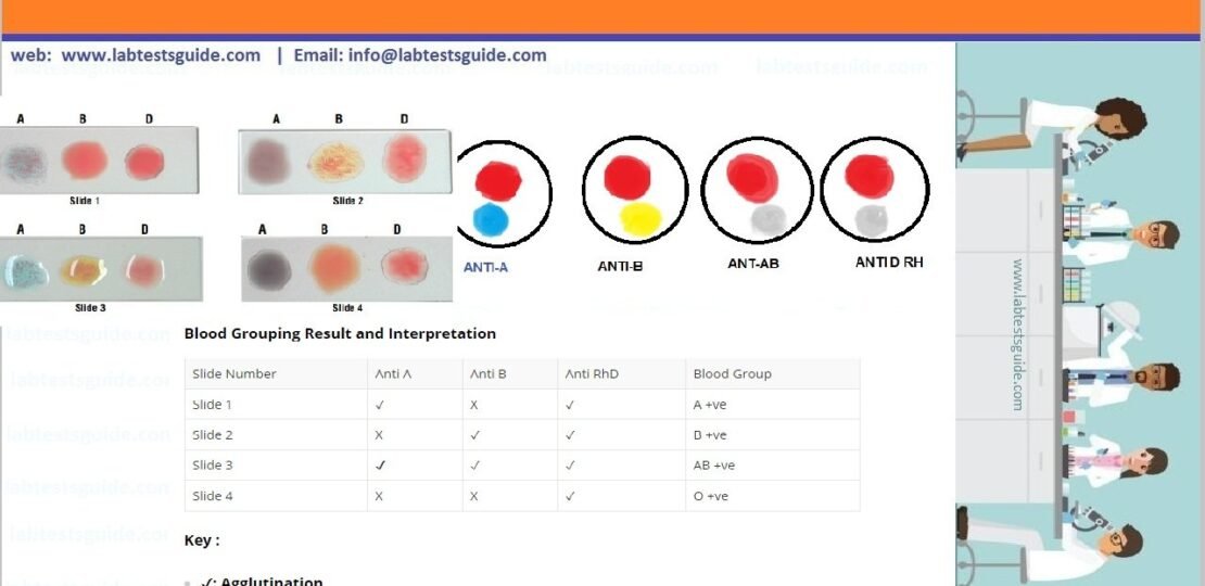 Blood Group Test