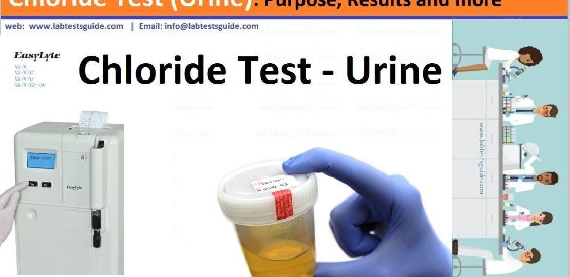 Chloride Test (Urine)