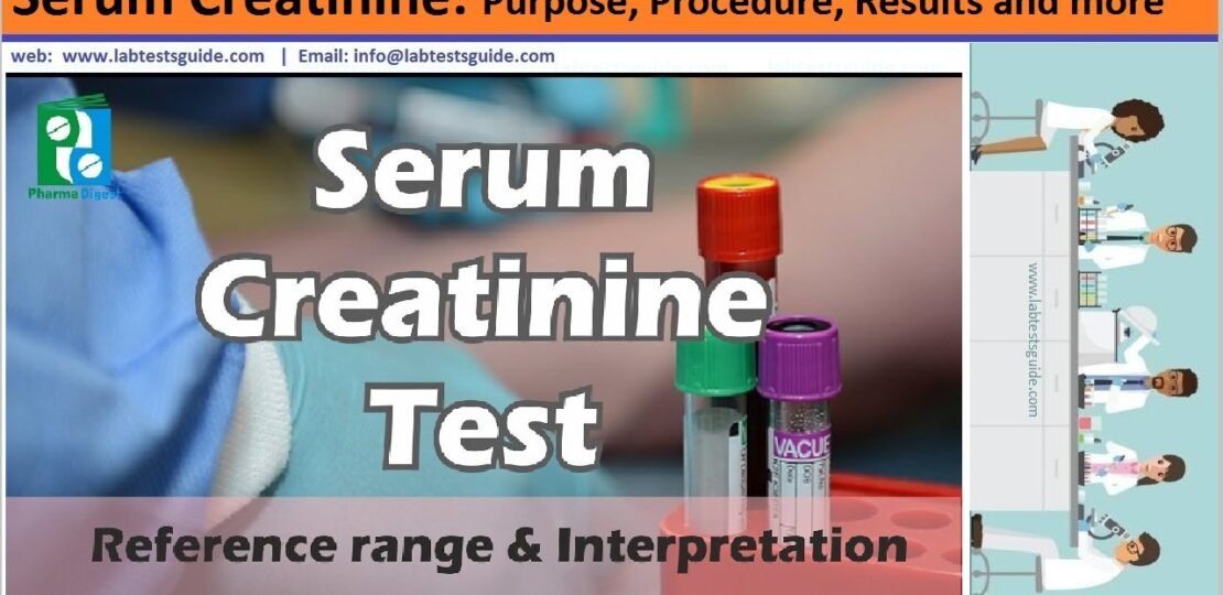 Creatinine