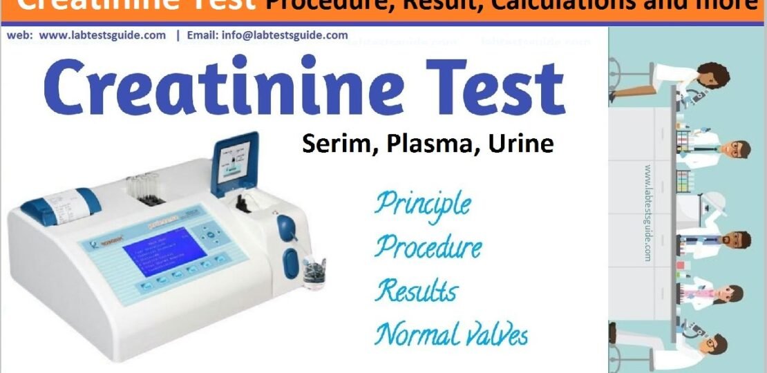 Creatinine Test