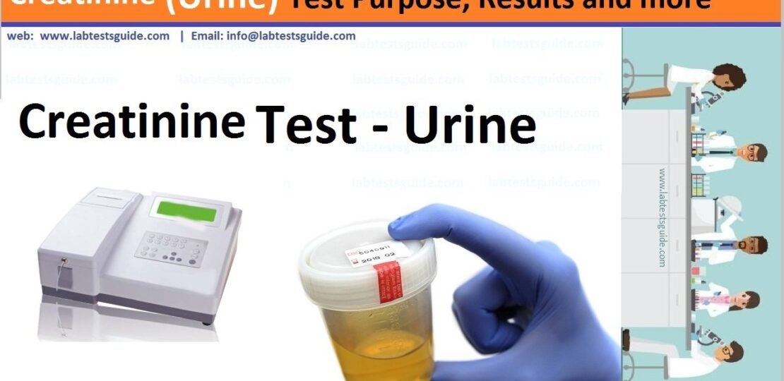 Creatinine (Urine)