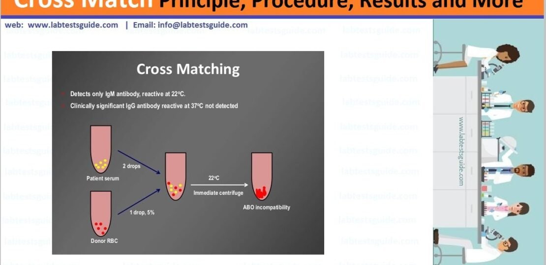 Cross Match