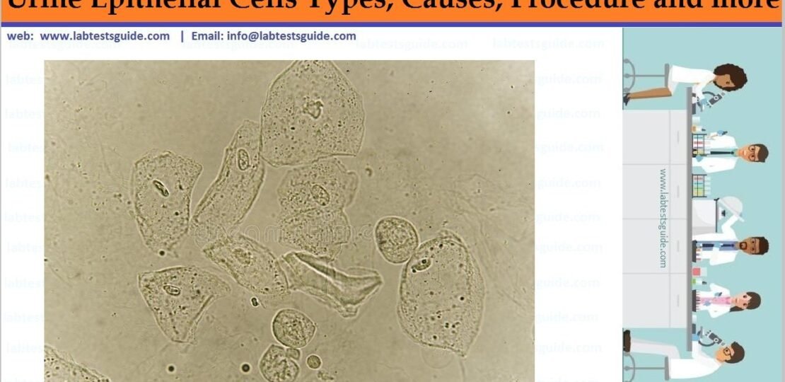 Epithelial Cells