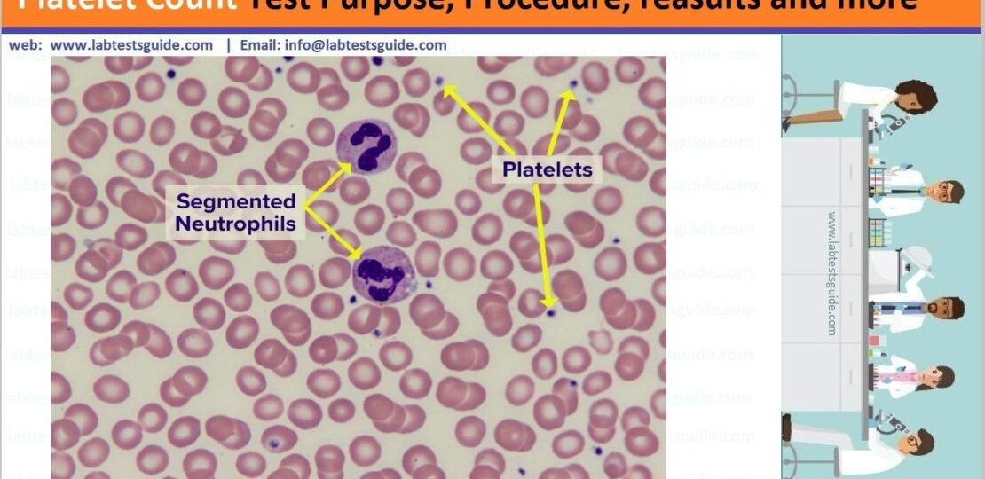 Platelet-Count