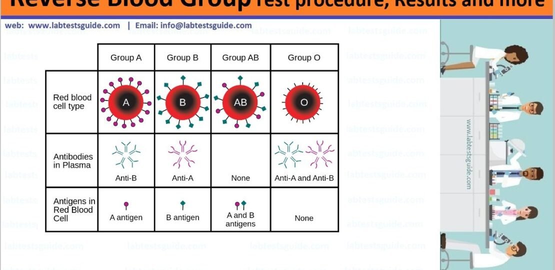 Reverse Blood Group