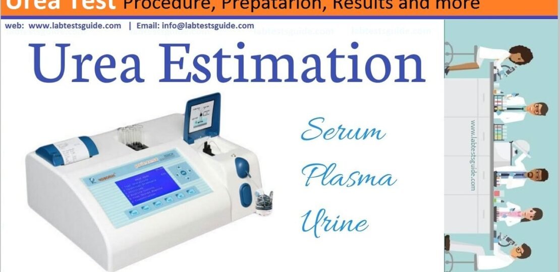 Urea Test