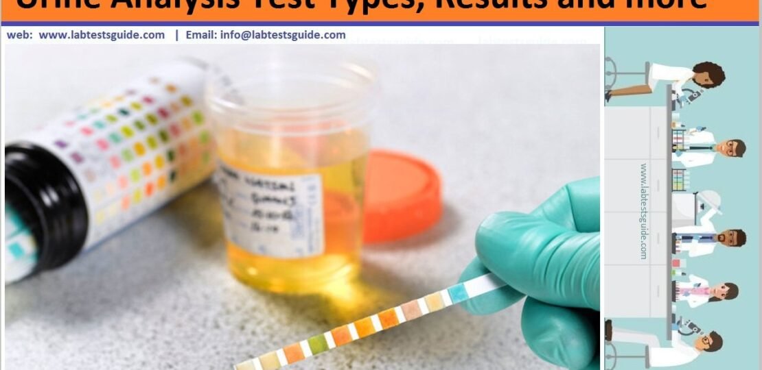 Urinalysis