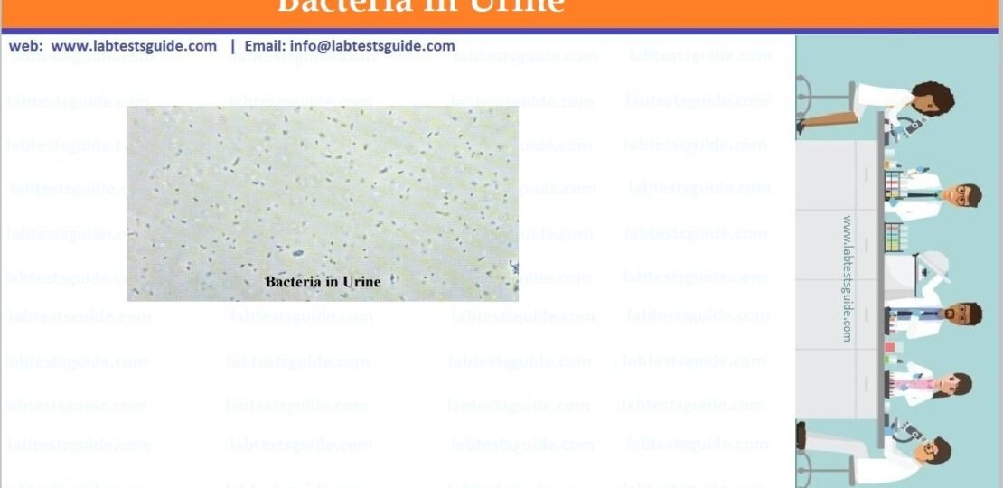 Urine Bacteria