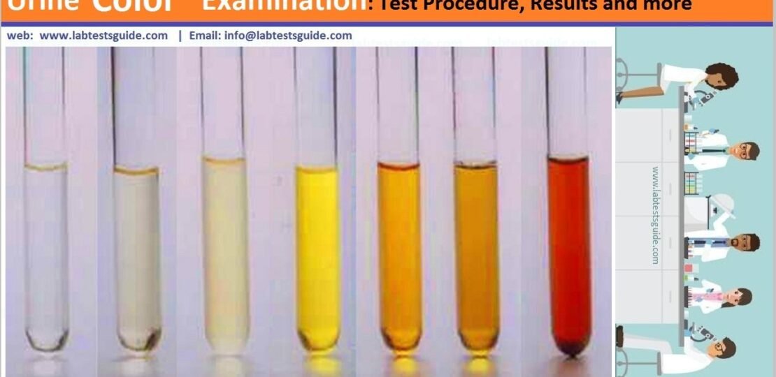 Urine Color 1