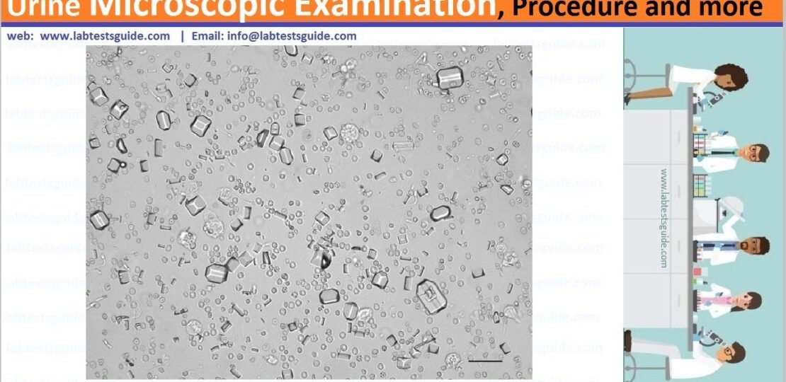 Urine Microscopic Examination