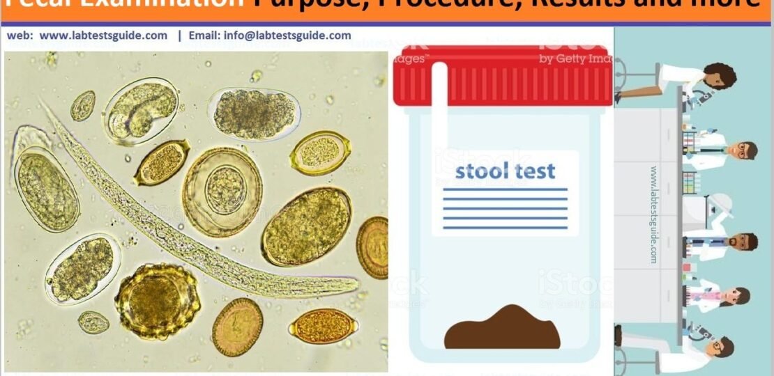 Fecal Examination